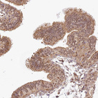 Anti-TUBGCP2 Antibody