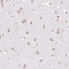 Anti-TUBGCP2 Antibody