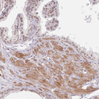 Anti-TUBGCP2 Antibody