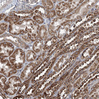 Anti-TTC37 Antibody