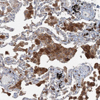 Anti-TTC37 Antibody