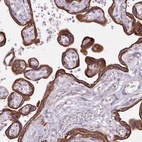 Anti-DCTN4 Antibody