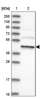 Anti-DCTN4 Antibody