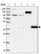 Anti-PDSS1 Antibody