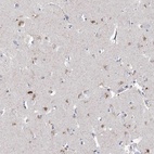 Anti-LRRC14B Antibody