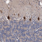 Anti-PPP2R2B Antibody