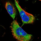 Immunofluorescent staining of human cell line U-251 MG shows localization to nucleoli & cytosol.