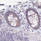 Anti-PLCD4 Antibody