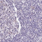 Anti-PLCD4 Antibody