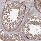 Anti-TBC1D23 Antibody