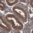 Anti-TBC1D23 Antibody