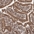 Anti-TBC1D23 Antibody