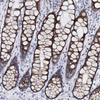 Anti-ARFIP2 Antibody