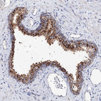 Anti-ARFIP2 Antibody