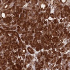 Anti-CCDC91 Antibody