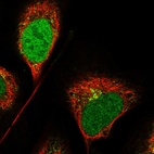 Anti-CCDC91 Antibody