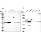 Anti-GPATCH11 Antibody