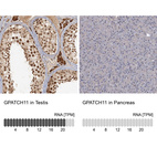 Anti-GPATCH11 Antibody