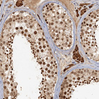 Anti-GPATCH11 Antibody