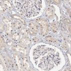 Anti-GPATCH11 Antibody