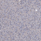 Anti-GPATCH11 Antibody