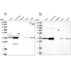 Anti-GPATCH11 Antibody