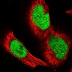 Anti-GPATCH11 Antibody