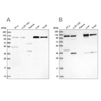 Anti-USO1 Antibody