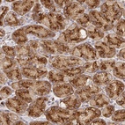 Anti-USO1 Antibody