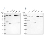 Anti-USO1 Antibody