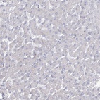 Anti-FAM216A Antibody