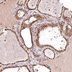 Anti-PYROXD1 Antibody