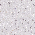 Anti-PYROXD1 Antibody