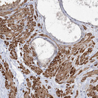 Anti-ARSI Antibody