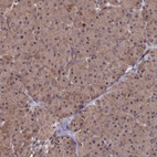 Anti-SUPV3L1 Antibody