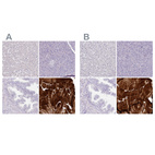 Anti-MYOZ1 Antibody