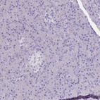 Anti-MYOZ1 Antibody