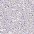 Anti-MYOZ1 Antibody