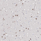 Anti-FRMD4A Antibody