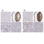 Anti-BFSP2 Antibody