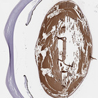 Anti-BFSP2 Antibody