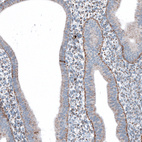 Anti-ME3 Antibody