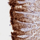 Anti-PSAPL1 Antibody