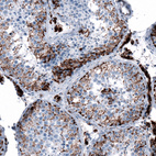 Anti-ME3 Antibody