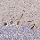 Anti-NHLRC2 Antibody