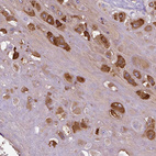 Anti-PRG2 Antibody