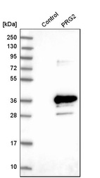 Anti-PRG2 Antibody