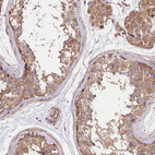 Anti-CEP295 Antibody