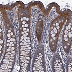 Anti-CEP295 Antibody