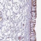 Anti-C1QTNF5 Antibody